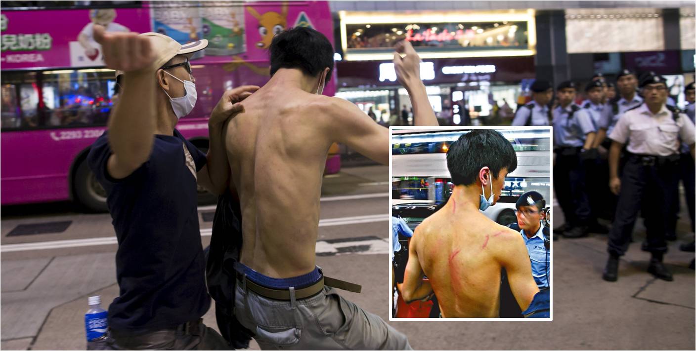 Leung (inset) shows injuries to his back. An unnamed man apparently attacks Leung in front of policemen. Photos: Reuters, Apple Daily Leung (inset) shows injuries to his back. An unnamed man apparently attacks Leung in front of policemen. Photos: Reuters, Apple Daily