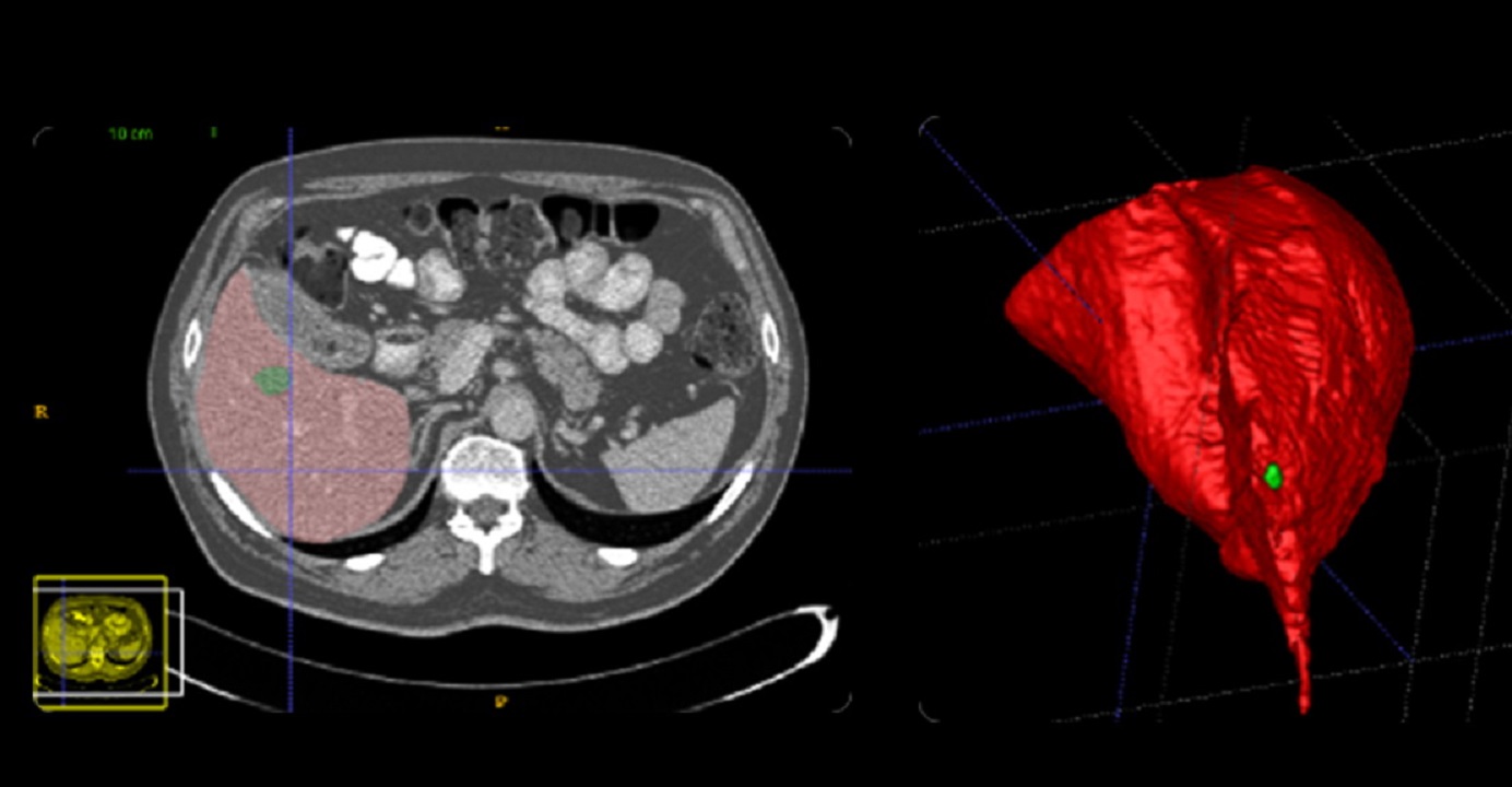 Imsight aims to ease the workload of doctors by offering medical imaging analysis powered by artificial intelligence. Photo: Internet Imsight aims to ease the workload of doctors by offering medical imaging analysis powered by artificial intelligence. Photo: Internet