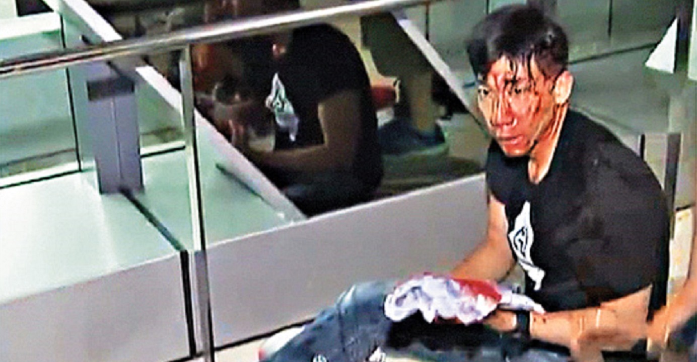 Former TVB journalist Ryan Lau was among those who suffered injuries in the Yuen Long attacks. Photo: Internet Former TVB journalist Ryan Lau was among those who suffered injuries in the Yuen Long attacks. Photo: Internet
