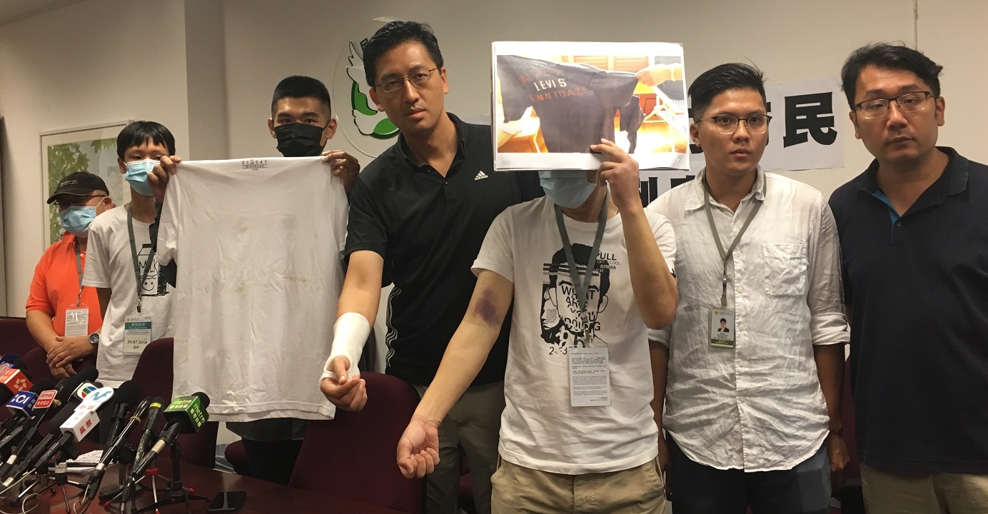 Democratic Party lawmaker Lam Cheuk-ting (center) holds a press conference on Wednesday along with some other victims and witnesses of Sunday’s train station attacks in Yuen Long. Photo: HKEJ Democratic Party lawmaker Lam Cheuk-ting (center) holds a press conference on Wednesday along with some other victims and witnesses of Sunday’s train station attacks in Yuen Long. Photo: HKEJ