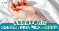 水痘感染不可輕視