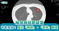 解除肺結節疑雲