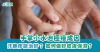 手掌小水泡極癢成因