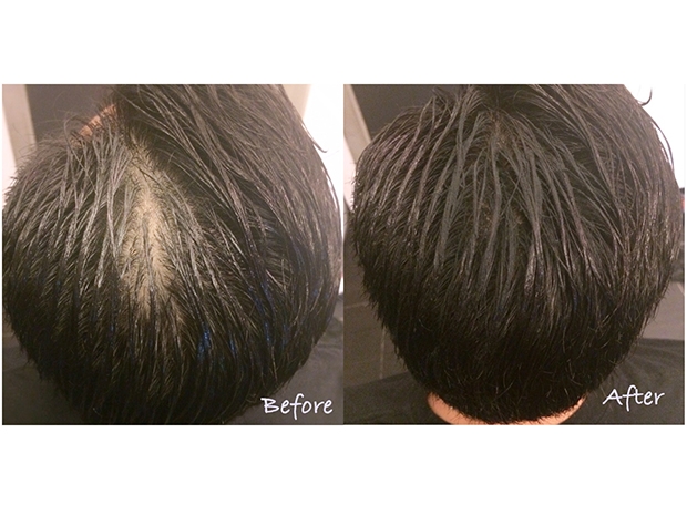 博客Ling：變魔髮